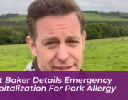 matt baker details emergency hospitalization for pork allergy giMG