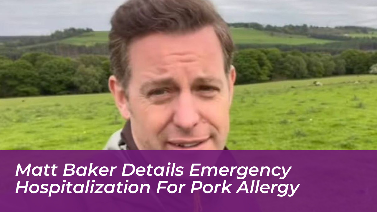 matt baker details emergency hospitalization for pork allergy giMG