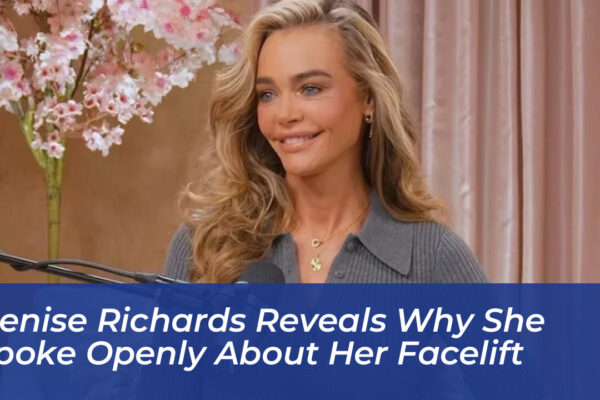 denise richards reveals why she spoke openly about her facelift Embk