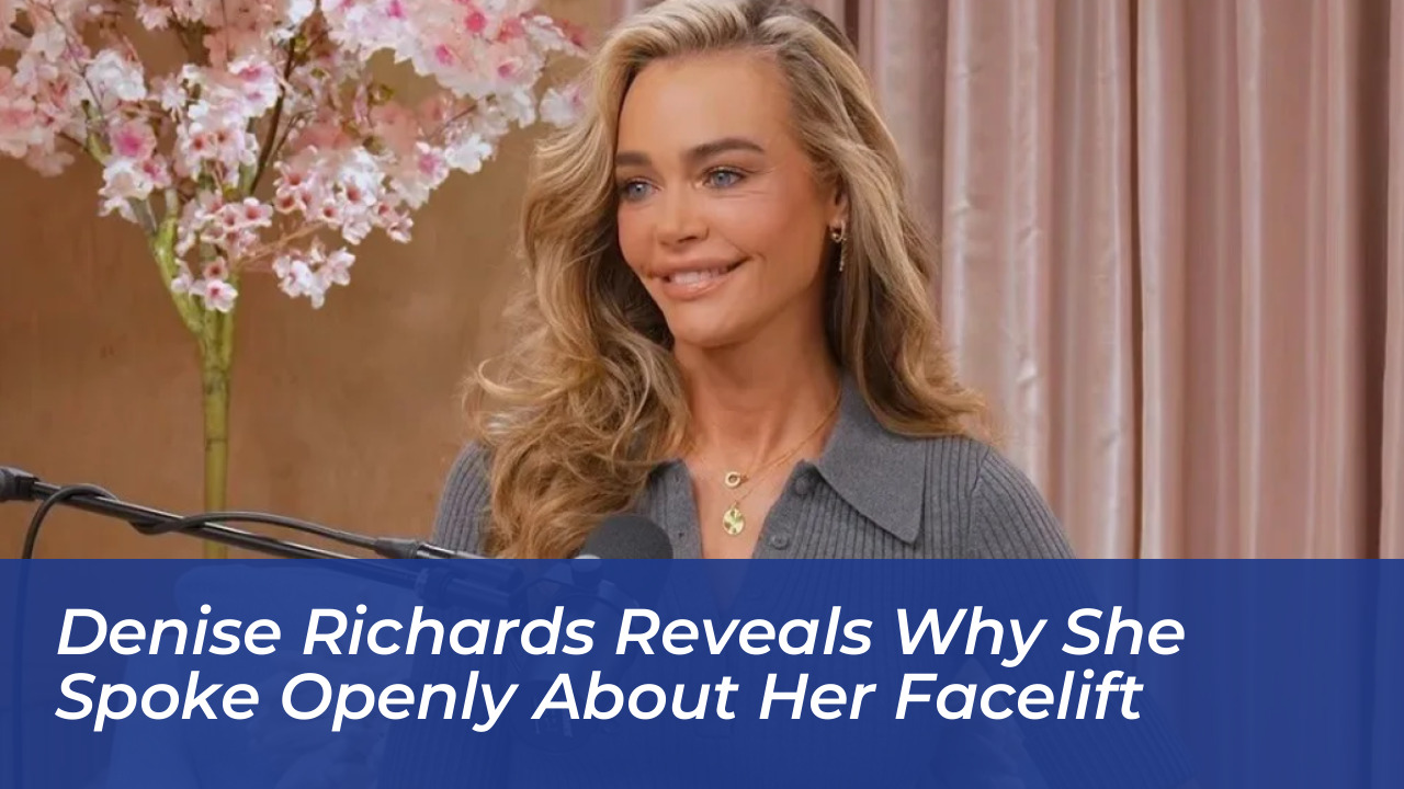 denise richards reveals why she spoke openly about her facelift Embk