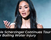 nicole scherzinger continues tour after boiling water injury E2q6