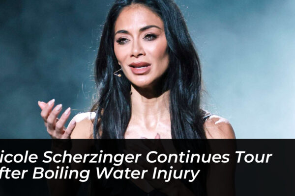 nicole scherzinger continues tour after boiling water injury E2q6