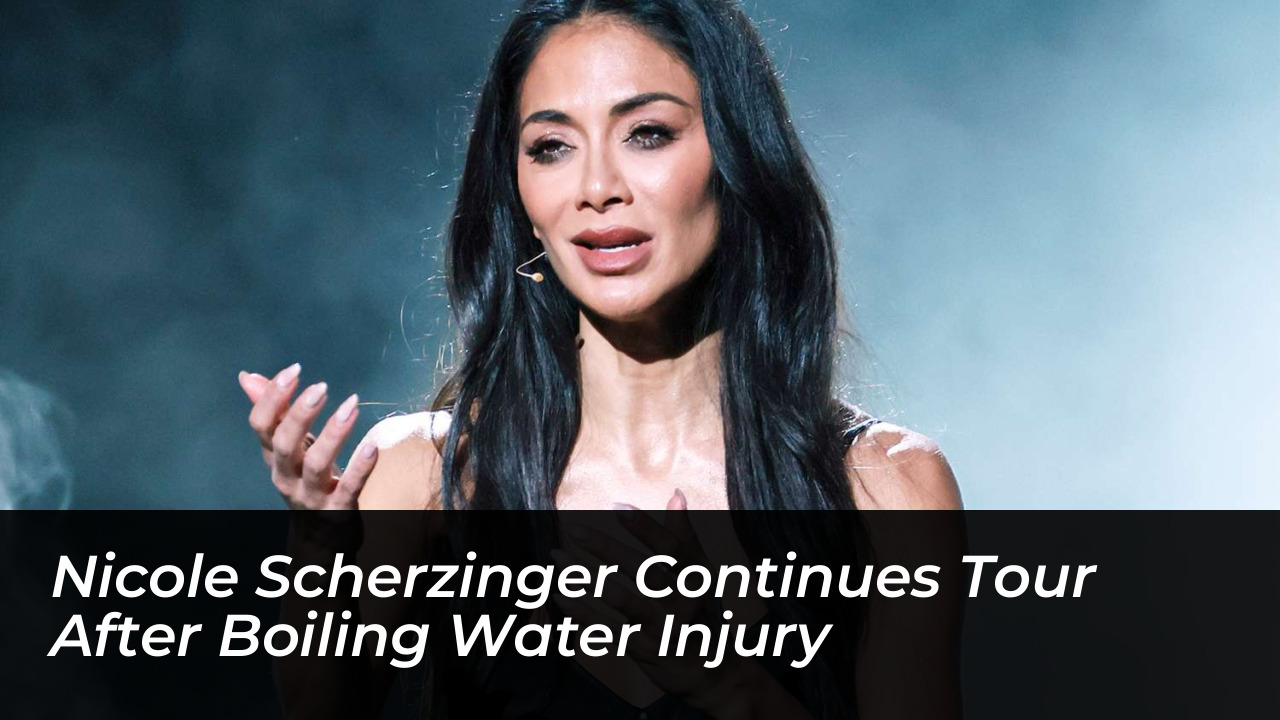 nicole scherzinger continues tour after boiling water injury E2q6
