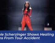 nicole scherzinger shows healing leg burns from tour accident diqc