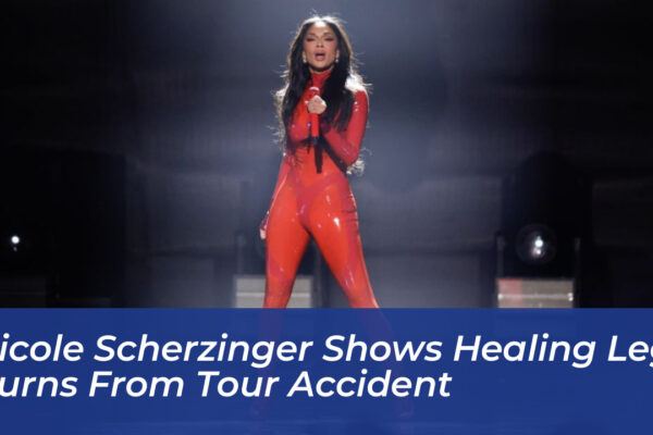 nicole scherzinger shows healing leg burns from tour accident diqc
