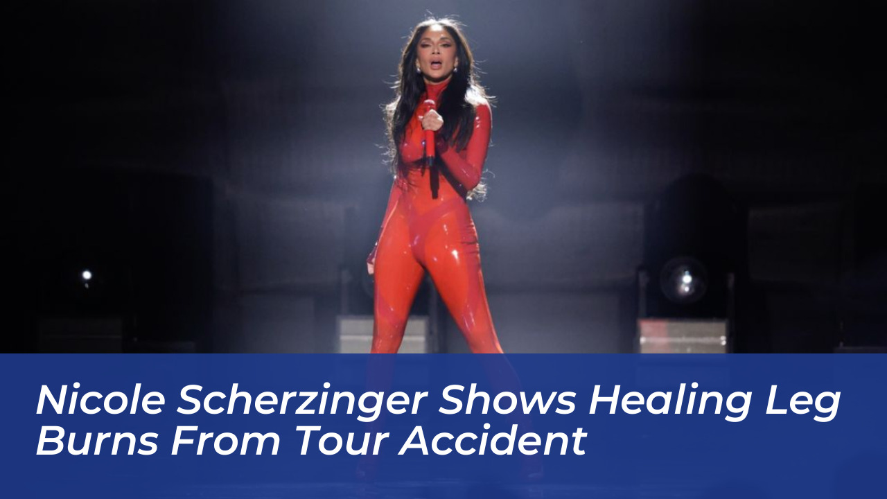 nicole scherzinger shows healing leg burns from tour accident diqc