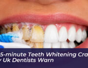 the 5 minute teeth whitening craze why uk dentists warn f3kl